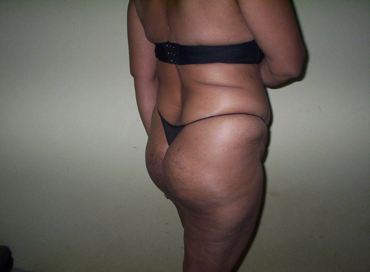 Gorgeous Full Nude Jaipur Hotties Naughty Revealing Pics - photo 28