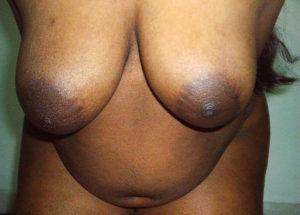 big desi nude image nipples